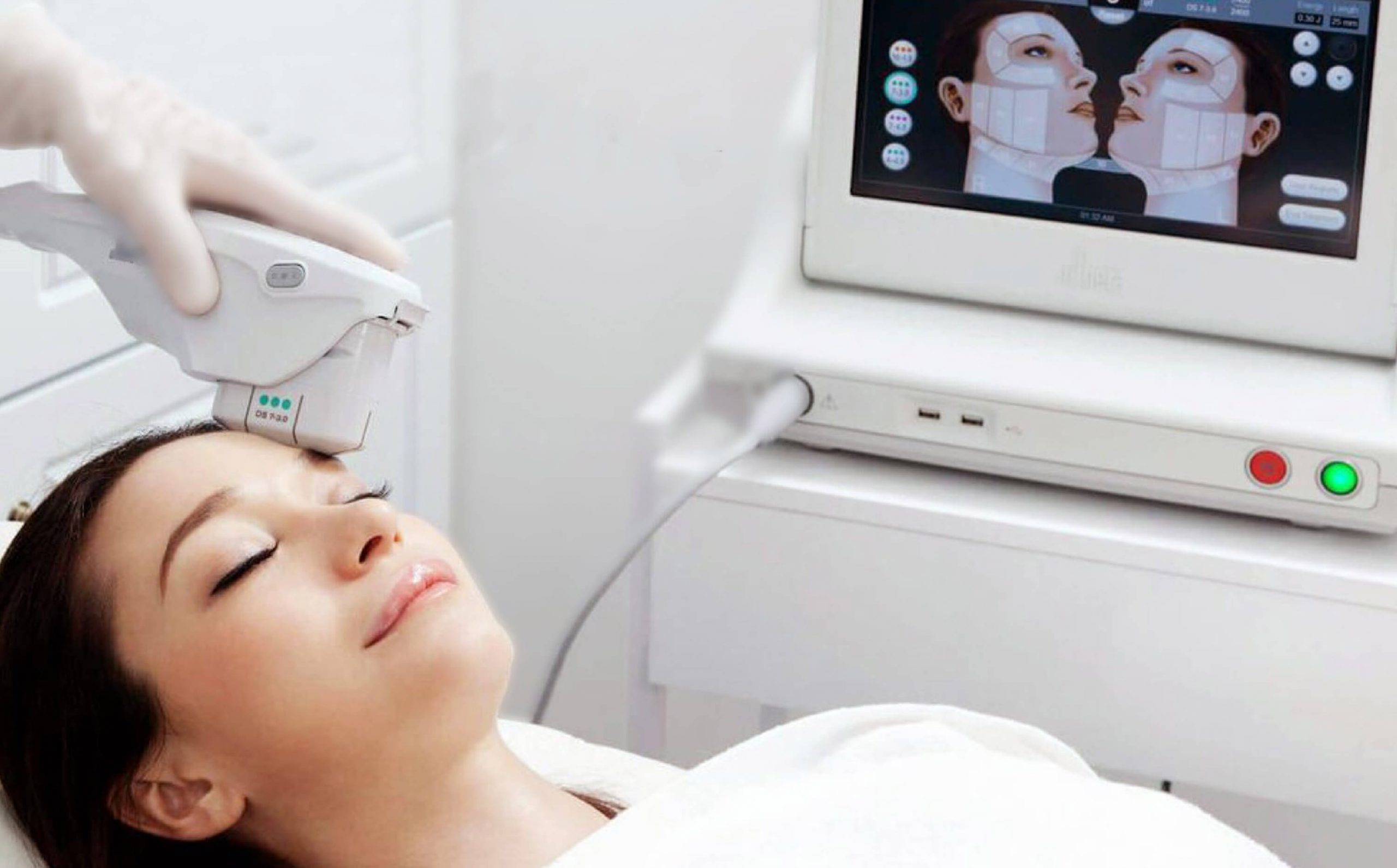 A doctor performing a treatment on a patient's face using Ultherapy machine. 