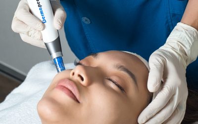 Is Dermapen Microneedling And Plinest The Best Acne Scar Treatment?