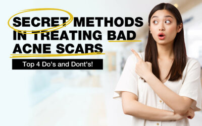 Top 4 Do’s and Dont’s! – Dr. Abby’s SECRET Methods in Treating Bad Acne Scars