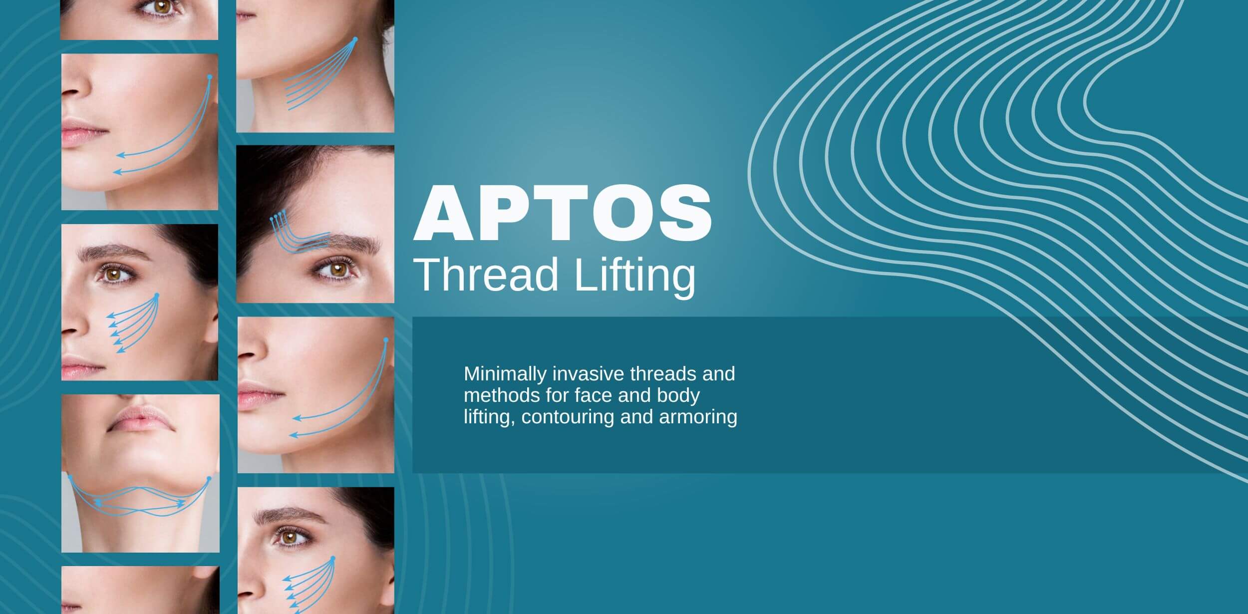 Aptos Thread Lift - Dr Abby Clinic