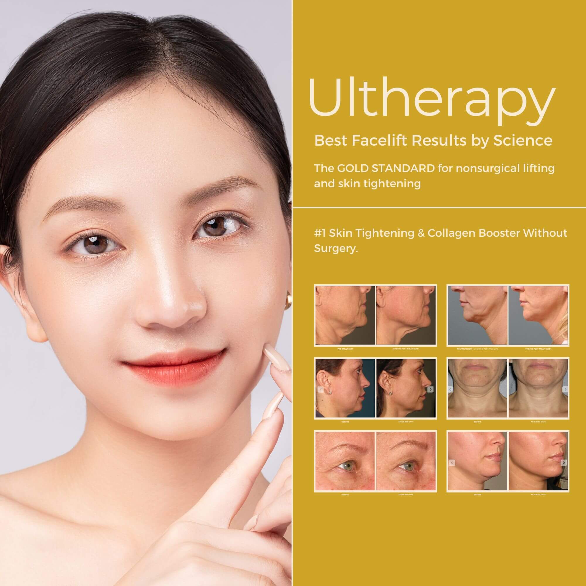AbClinic_Ultheraphy_Mobile_v2