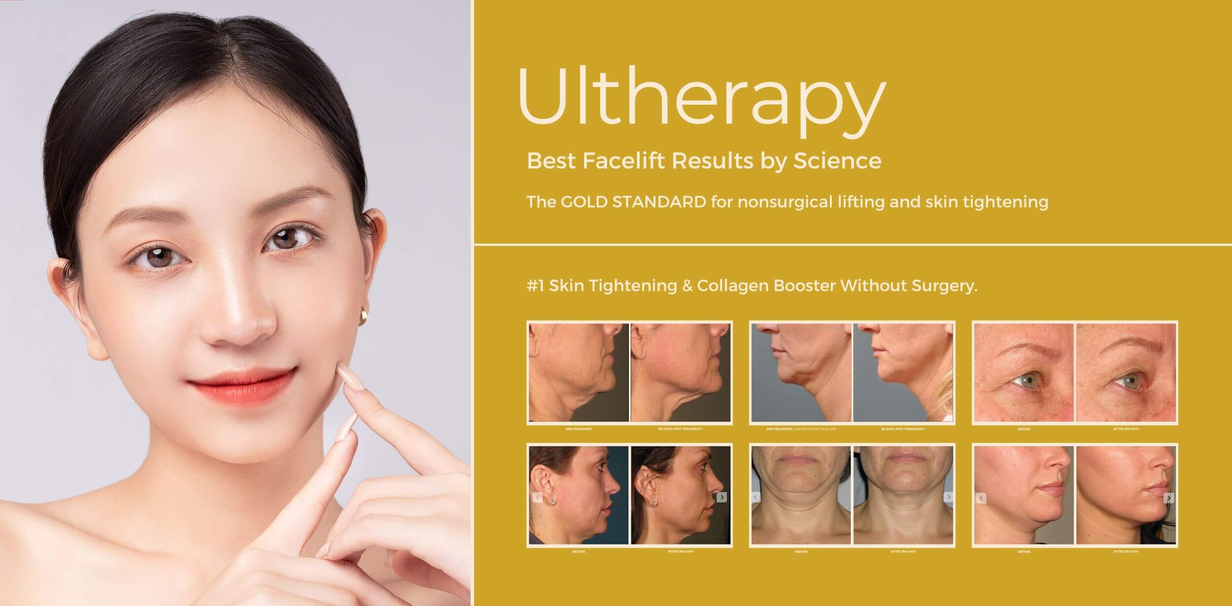 AbClinic_Ultheraphy_v2