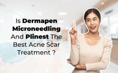 Is Dermapen Microneedling And Plinest The Best Acne Scar Treatment?