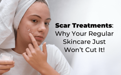 Scar Treatments: Why Your Regular Skincare Just Won’t Cut It!
