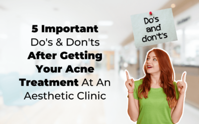 5 Important Do’s & Don’ts After Getting Your Acne Treatment At An Aesthetic Clinic