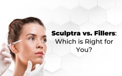 Sculptra vs. Fillers: Which is Right for You?