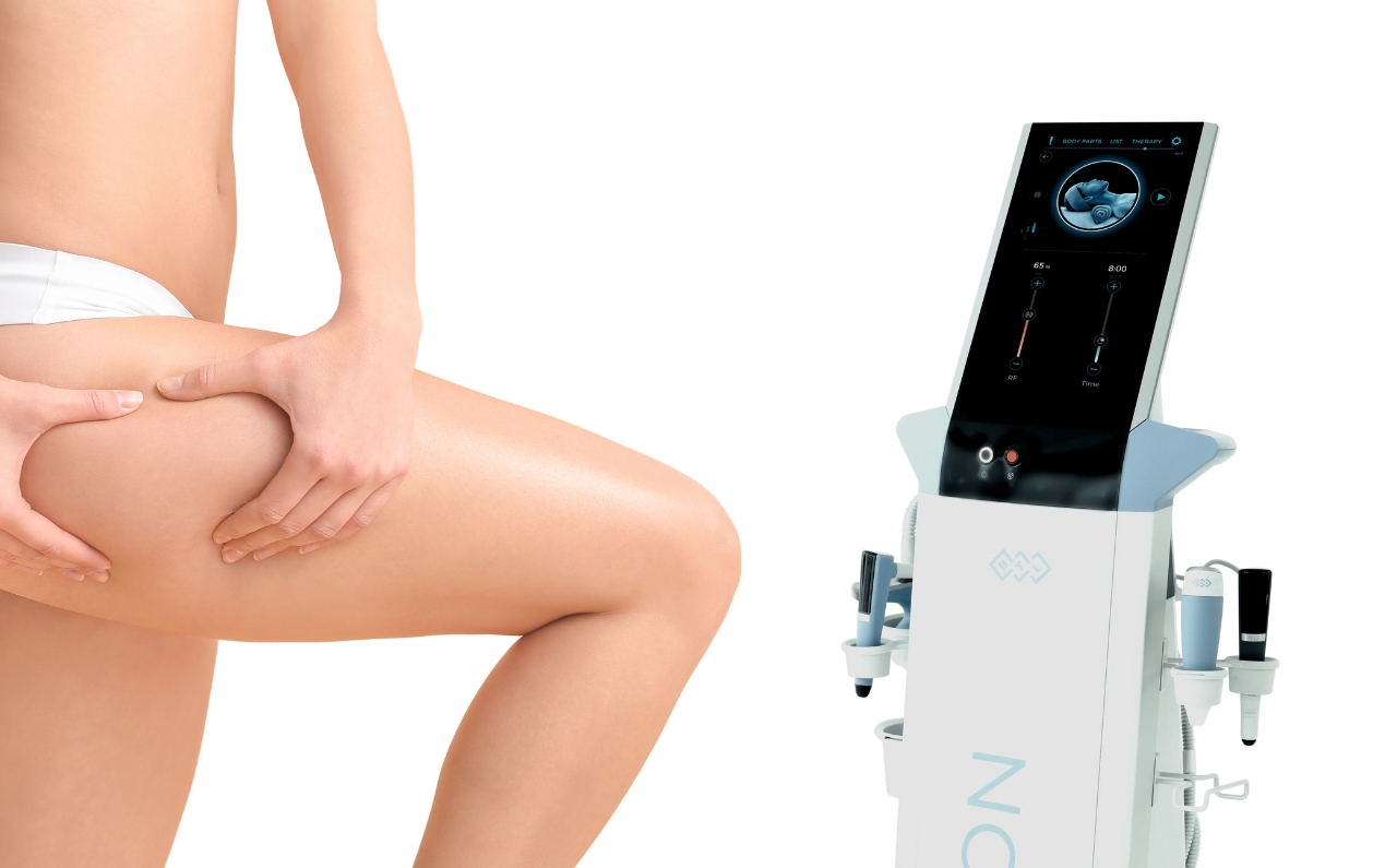 A woman, squeezing her thigh to show no signs of cellulite. Next to her, the BTL Exion device - used for cellulite reduction.