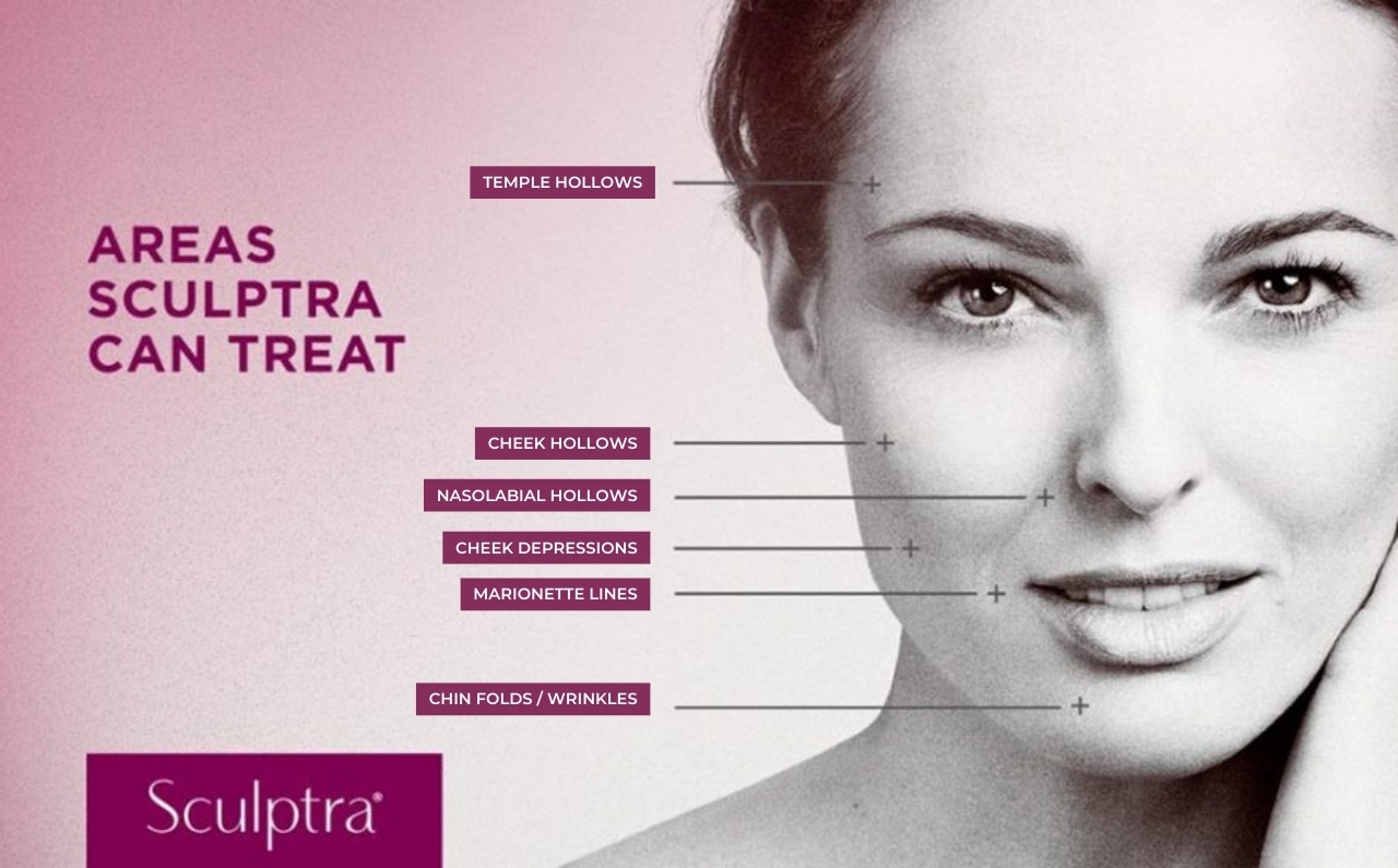 As a injectable aesthetic treatment, Sculptra offers numerous benefits.