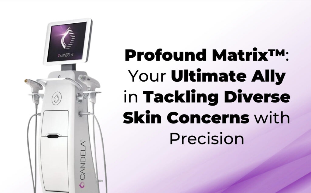 Profound Matrix is the latest aesthetic device which offers numerous benefits to a wide range of skin concerns.