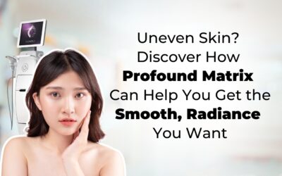 Uneven Skin? Discover How Profound Matrix Can Help You Get the Smooth, Radiance You Want