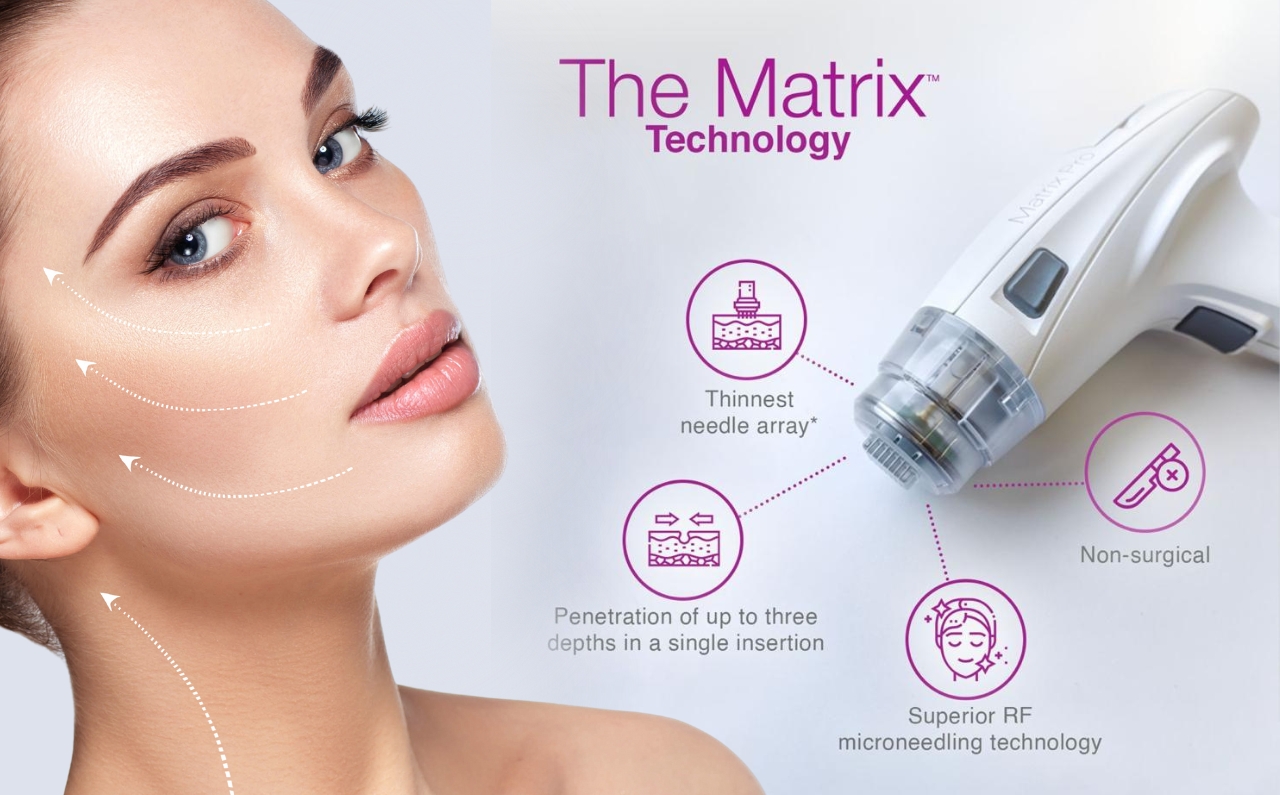 A woman with glowing skin and icons representing the benefits of Profound Matrix treatment for uneven skin.