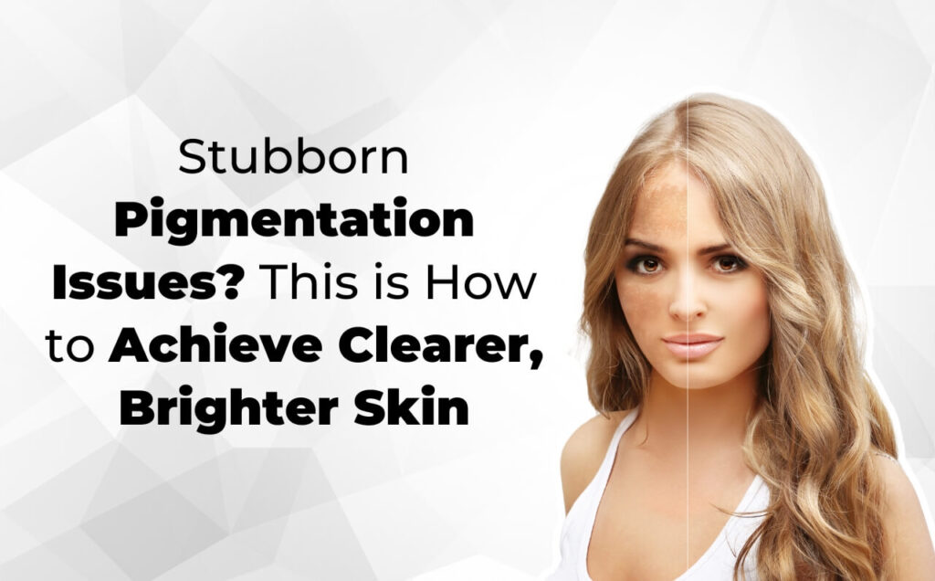 A blonde woman with radiant, clear skin, symbolising the results of effective pigmentation treatment.