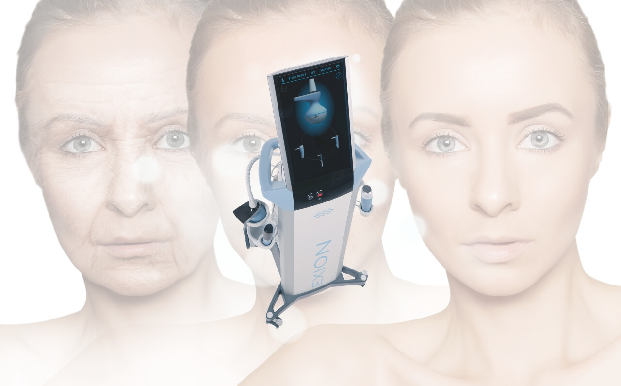 A woman in the background with youthful skin, while the BTL Exion device is displayed in the foreground. The device is designed to address early signs of ageing through advanced radiofrequency and ultrasound technology.