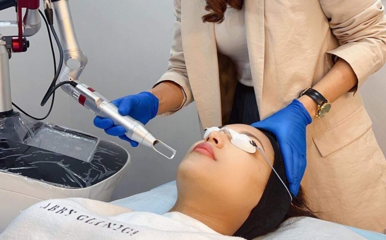 A woman receiving Pico Laser treatment at Dr Abby Clinic, highlighting the clinic's professional and precise skincare approach.